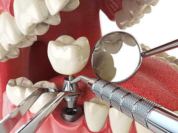 Best Cosmetic Emergency Dentistry in Holly Hill, SC